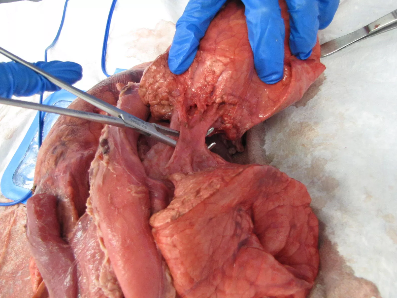 Lung Dissection Model For Vascular Evaluation